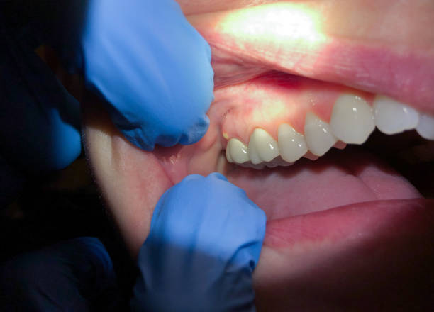 Best Emergency Dental Care for Trauma or Injury in Rainier, WA