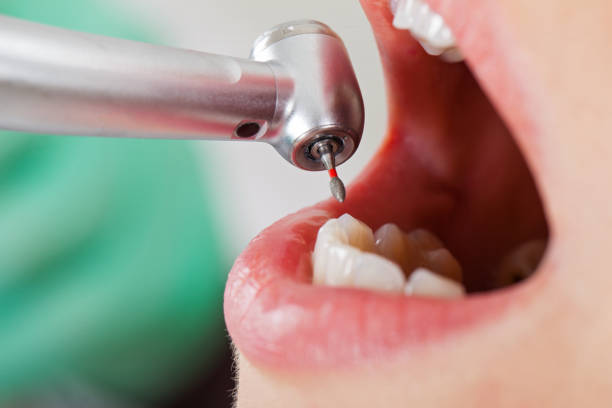 Best Emergency Treatment for Toothache in Rainier, WA